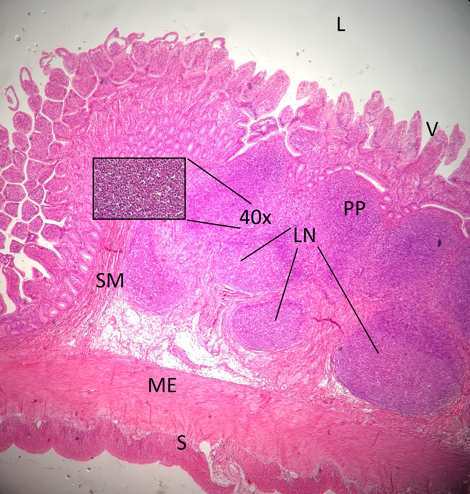 Intestine Composite 10x Histology